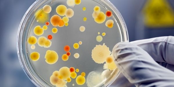 bacteria on agar plate